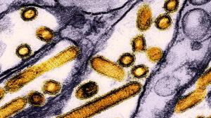 Undetected human cases of bird flu have been confirmed in the U.S